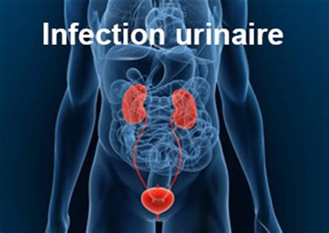 Méat urinaire : femme, homme, schéma, inflammation